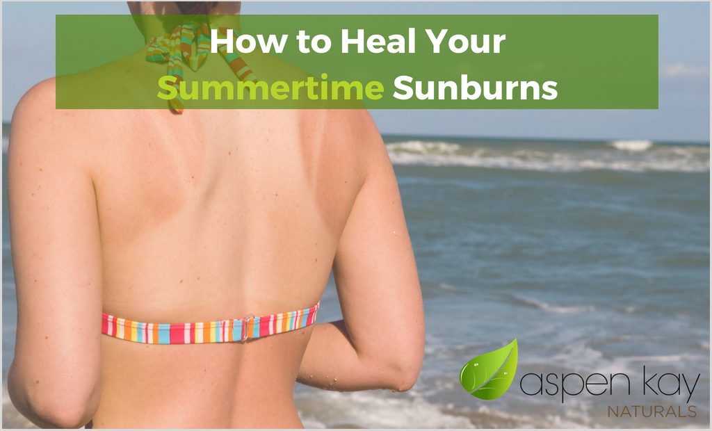 How to Heal Your Summertime Sunburns
